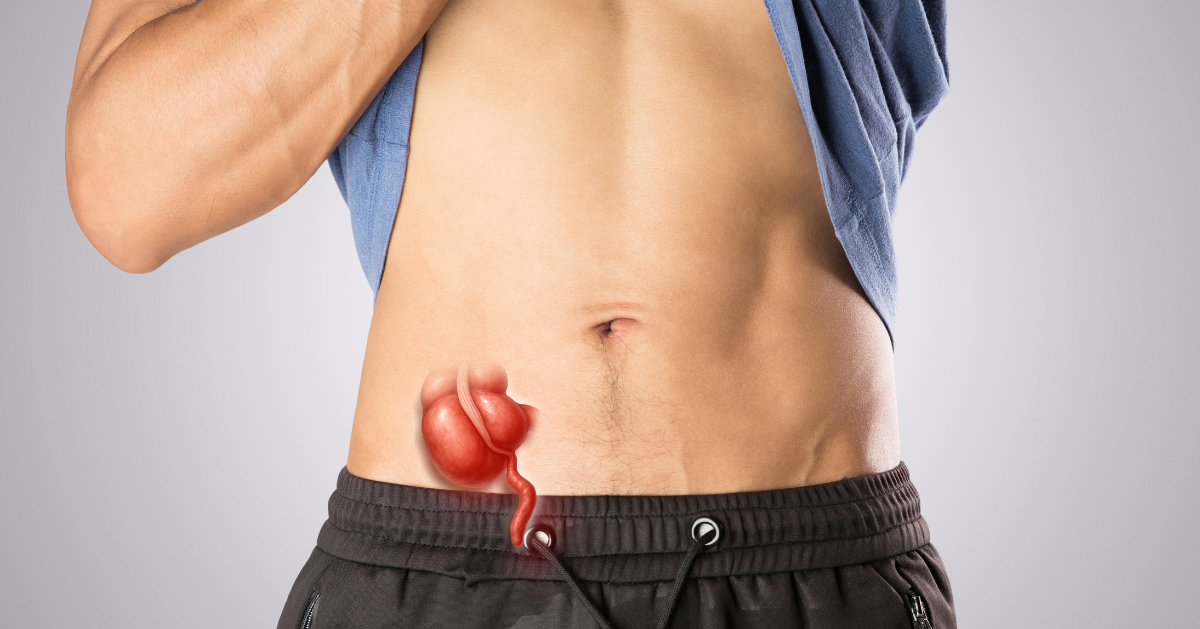 Appendicitis Treatment