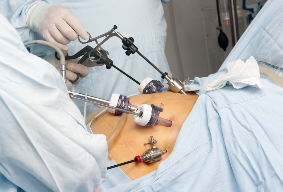 Dashospital Laparoscopic Surgery