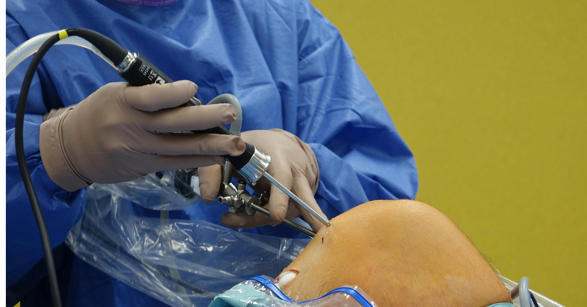 Knee Replacement Surgery