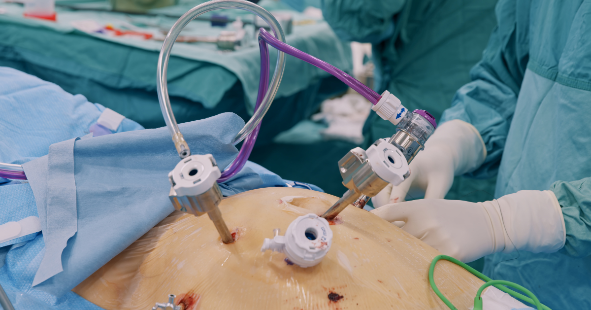 Dashospital Laparoscopic Surgery