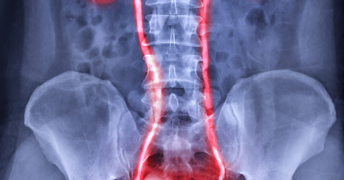 UTI Symptoms Causes Treatment