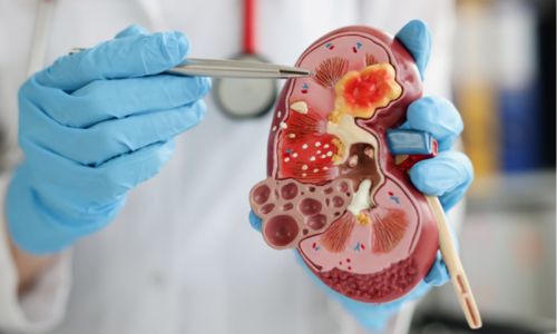 Kidney Dialysis Department