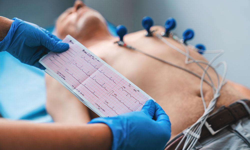 Cardiac Strain Imaging Department